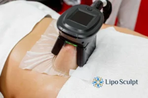 Cryolipolysis Helping You Getting that Perfect Summer Body 3 Cryolipolysis Newark on Trent can give you the best summer body - contact us today!