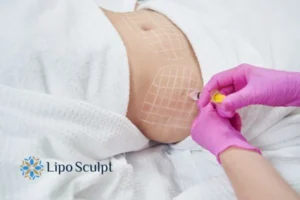 Are The Results From Aqualyx Permanent? 1 Do you want to know how long Aqualyx Newark on Trent results last?