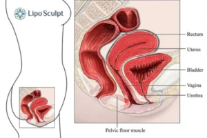 Treatment For A Leaky Bladder 2 How EM Chair treatment Newark on Trent can help Leaky bladder issues. Read more now!