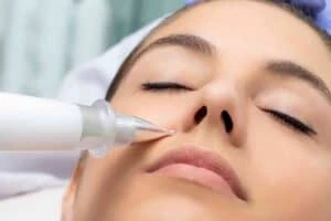 Best Actinic Keratoses Removal 3 Actinic keratoses Newark on Trent solutions - book in today!